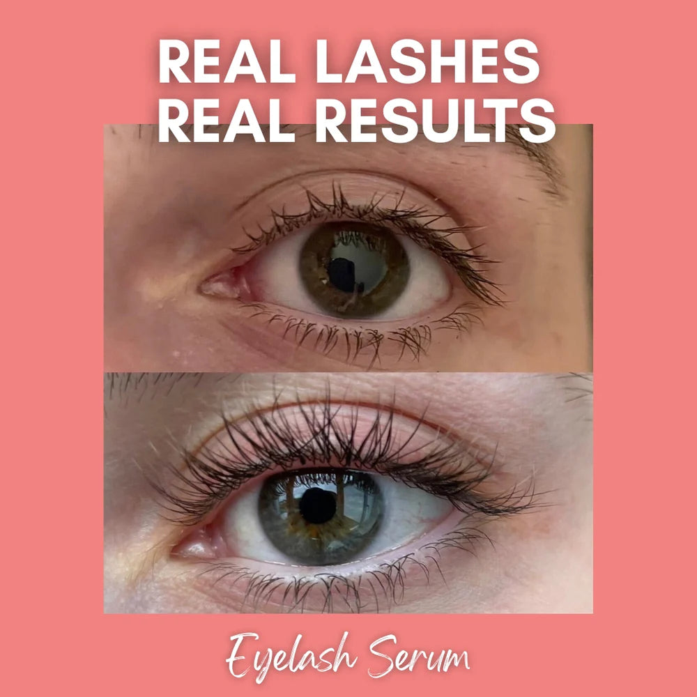 Lash Fridays Eyelash Serum - 5ml